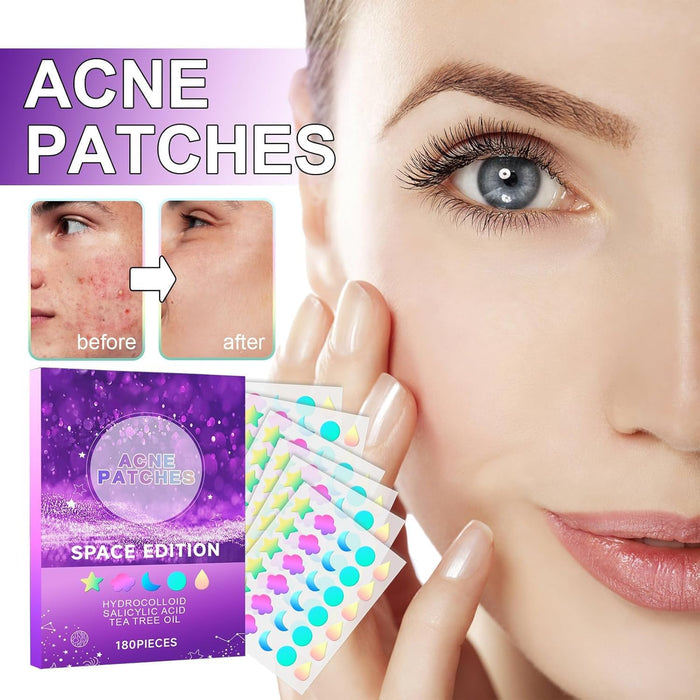 Azonee Pimple Patches for Face, Hydrocolloid Acne Patches Cute Star Zit Covers Spot Cover Stickers 180 Pcs with Tea Tree Salicylic Acid Natural Green Algae Extract Blemish Spot Stickers, 5 Styles