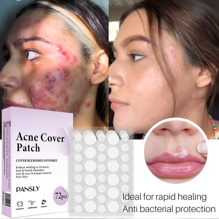 KASTWAVE Patches for Face, Pimple Cosmetics Original Patch - Pimple Spot Treatment, Invisible Pimple Patches For Covering Zits Andblemishes, Invisible Skin Sticker (72 Count)