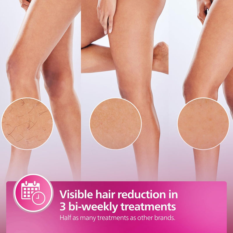 Lumea IPL Epilator with 3 attachments for Face, Body, and Precision Areas (Underarm & Bikini) Cordless, Model: BRI955/60