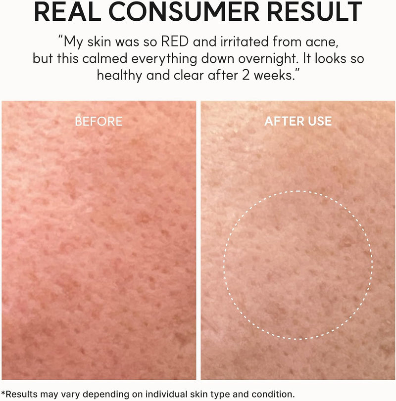 Eraser Soothing Cream, Facial Moisturizer with Centella & Ceramide, Hydrating Face Cream for Sensitive Skin, Lightweight Barrier Support, 50ml / 1.69 fl oz