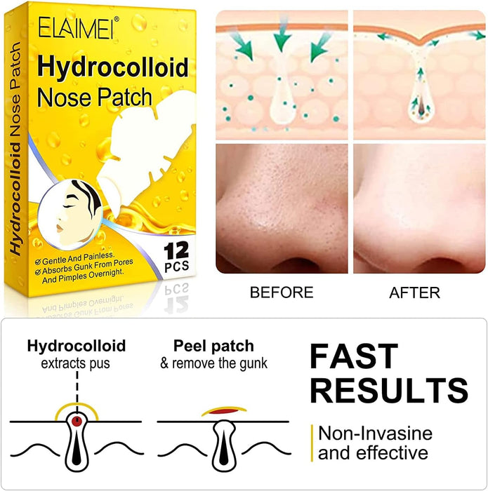 SYOSI Hydrocolloid Nose Patch, 1 Pack-12 Pcs, Blackhead Nasal Patch, Deep Cleansing Pore Strips, Remove Blackheads and Unclog Pores, Clean Oily Skin