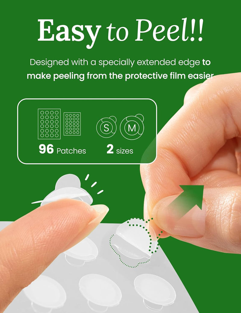 Troubless Invisible Pimple Patch Classic, 96 Patches (2 Sizes) – Ultra Thin Hydrocolloid Spot Treatment for Daytime Use, Easy Peel, Fast Healing, Absorbs Oil & Impurities, For Acne-Prone Skin