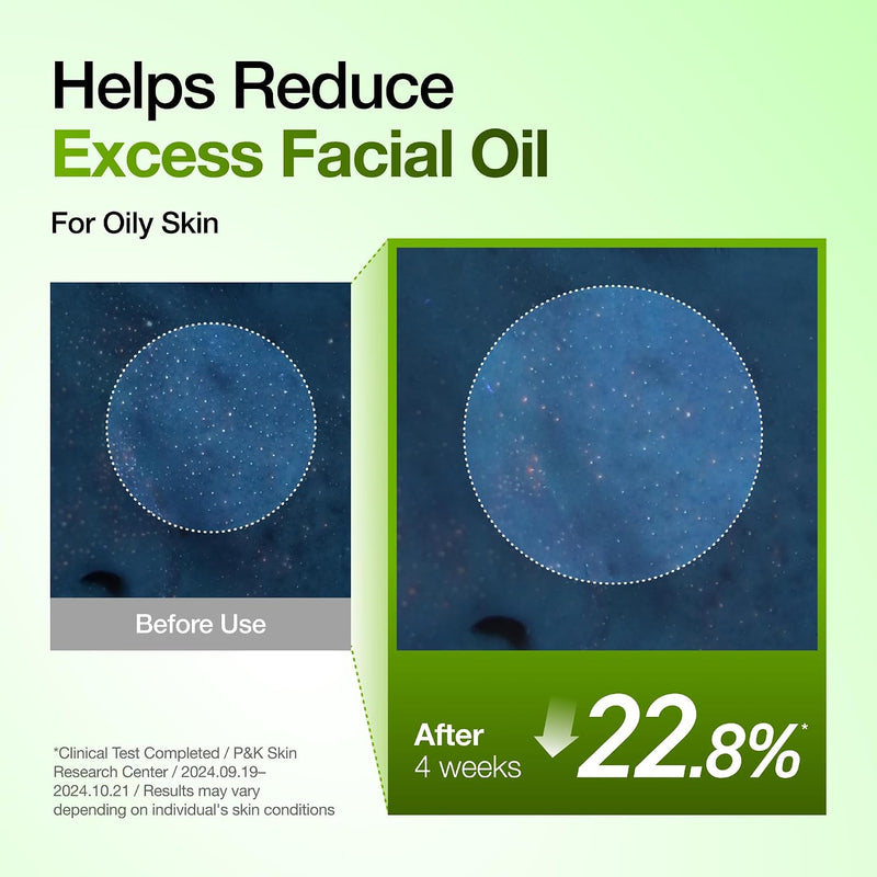 Azelaic Acid 10 Hyaluron Redness Soothing Serum, Facial Serum for Sensitive skin, Hyaluronic Acid, Niacinamide, Spot Care, Natural Color, Vegan, Korean Skincare (30ml/ 1.01 fl oz.)