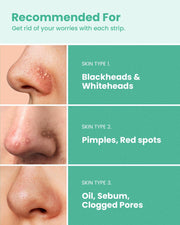 GLAM UP Spotless Nose Patch Hydrocolloid Coverage for Nose Pores,Zits and Oil - Strong Waterproof to Absorb Acne Nose Gunk, and Calm Treatment with Tea Tree (12 Patches)