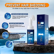 Minoxidil Hair Serum spray for Men and Women, 5% Minoxidil Hair Serumpromotes hair growth, makes hair and beard thicker and fuller - Other