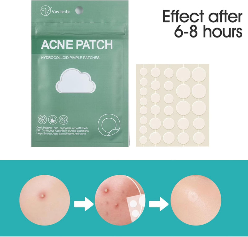 Vavilente Acne Pimple Patches, Hydrocolloid Acne Patches with Tea Tree Oil,Salicylic Acid & Calendula Oil,Pimple Patch for Face, Zit Patches,Pimple Stickers(150 Count)