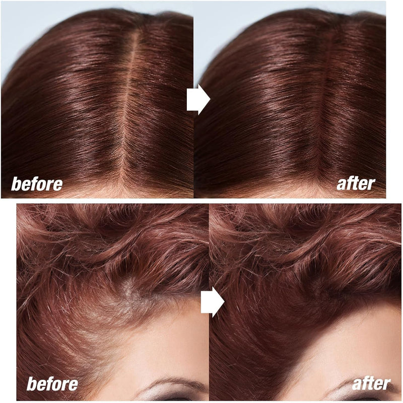 Hairline Shadow Stick, Instant Hair Root Concealer Hair Powder Stick for Women and Men, Root Touch Up Hair Color for Thin Hair (04 Dark Auburn) - #04 Dark Auburn