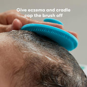 DermaFrida the SkinSoother Baby Bath Brush: Cradle Cap Brush for Babies, Baby Essential for Dry Skin, Cradle Cap Treatment and Eczema - SkinSoother Baby Bath Brush