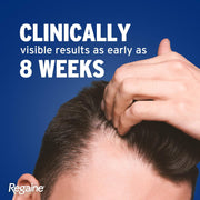 5% Minoxidil Topical Solution for Men 60ml - Clinically Proven Hair Regrowth Treatment Designed to Combat Hereditary Hair Loss and Promote Fuller, Thicker Hair