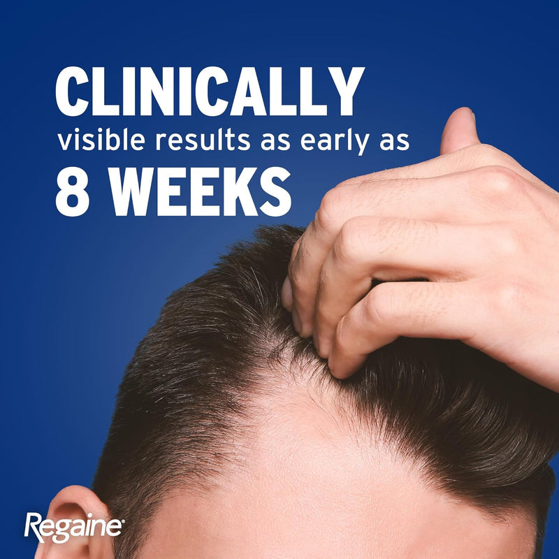 5% Minoxidil Topical Solution for Men 60ml - Clinically Proven Hair Regrowth Treatment Designed to Combat Hereditary Hair Loss and Promote Fuller, Thicker Hair