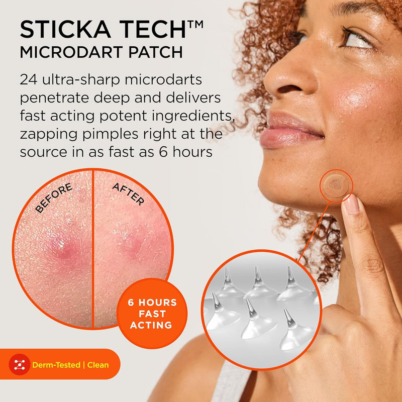 ZitSticka KILLA Kit - Pimple Patch, Spot Treatment,8 Patches and 8 Priming Swabs