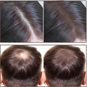 Hairline Powder Stick, Waterproof Hair Root Touch Up Powder for Thinning Hair and Bald Spots, Instant Hairline Shadow Conceals Hair Loss, Root Cover Up for Women and Men (Brown)