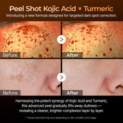 Peel Shot Kojic Acid Turmeric Serum Exfoliating Dark Spot Corrector With Aha/Bha & Niacinamide, Brightening & Even Complexion Facial Serum 2.71 Fl Oz (Pack of 1)