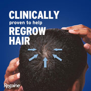 5% Minoxidil Topical Solution for Men 60ml - Clinically Proven Hair Regrowth Treatment Designed to Combat Hereditary Hair Loss and Promote Fuller, Thicker Hair