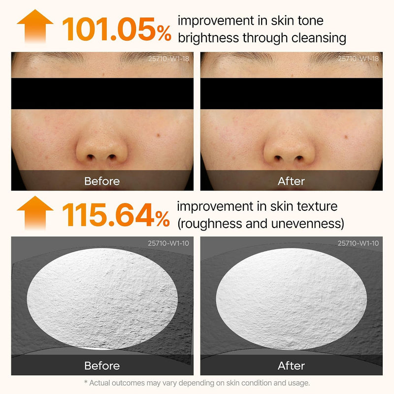 Peel Shot Kojic Acid Turmeric Serum Exfoliating Dark Spot Corrector With Aha/Bha & Niacinamide, Brightening & Even Complexion Facial Serum 2.71 Fl Oz (Pack of 1)